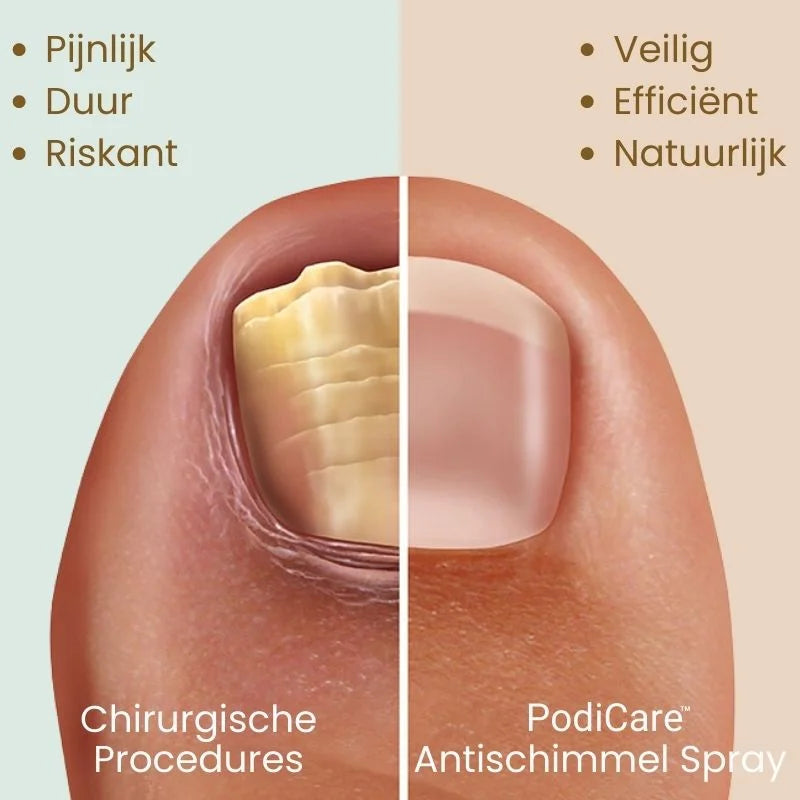 PodiCare™ Anti-Schimmel Spray | Schimmelvrije nagels in 7 dagen!