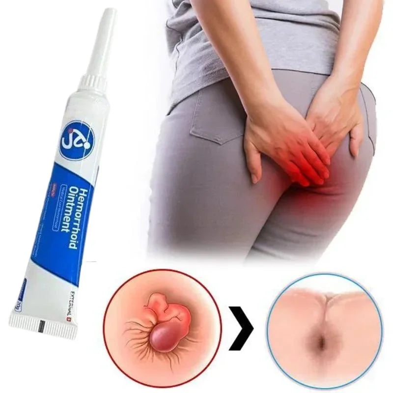 Direct verlost van aambeien en hun symptomen met HemoCare™!