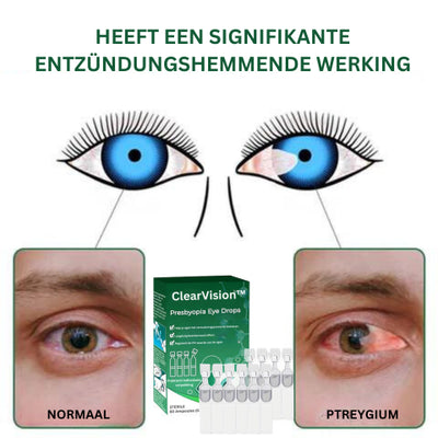 ClearVision™ Oogdruppels | Zie helder in 7 dagen!