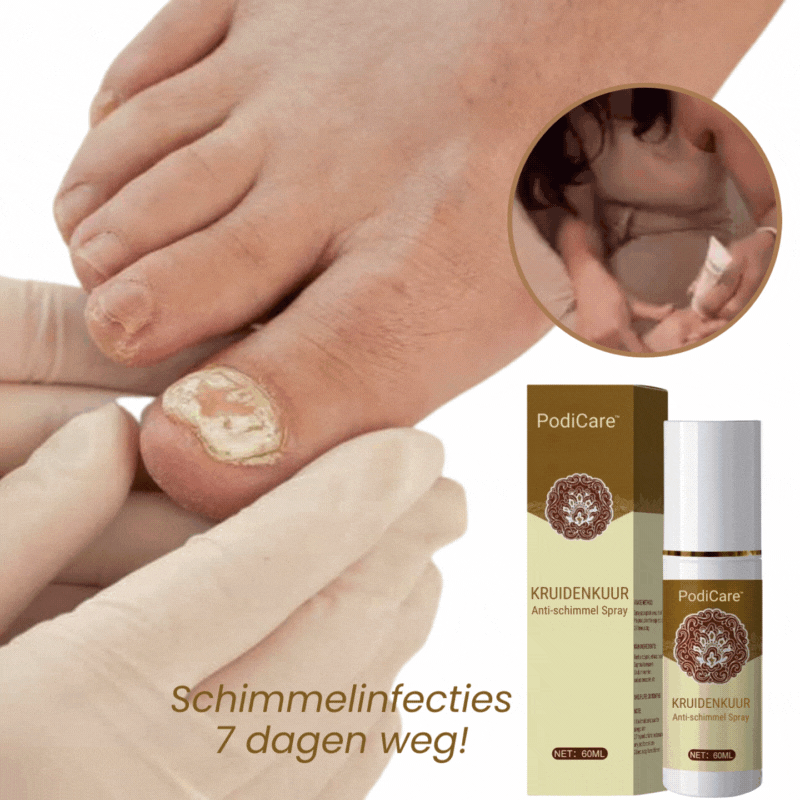 PodiCare™ Anti-Schimmel Spray | Schimmelvrije nagels in 7 dagen!