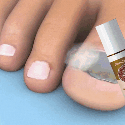 PodiCare™ Anti-Schimmel Spray | Schimmelvrije nagels in 7 dagen!