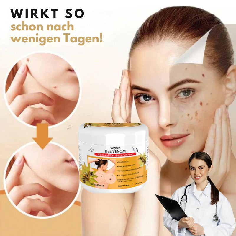 SkinClear™ Wrattenverwijderende Crème | Weg met vervelende huidwratten in slechts 7 dagen!