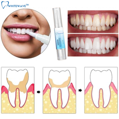 WhiteWave™ Tanden Bleken | Binnen 7 dagen prachtige, schone tanden!