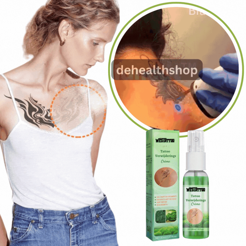 WegTattoo™ Creme  | Na 5 minuten af van je ongewenste tattoo's!
