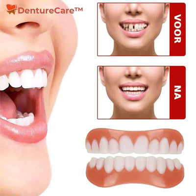 DentureCare™ Reline Kit | Voorkomt verschuiven van de prothese, zorgt voor comfort