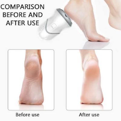 (Tijdelijk 50% Korting) FLOWSY | Electric Footskin cleaner™ - Flowsy